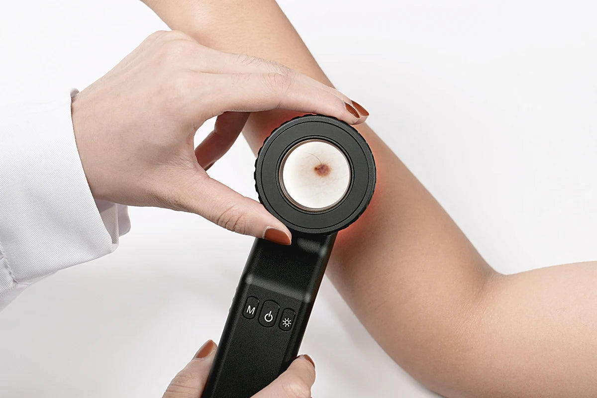 IBOOLO DE-4100 New Diagnostic Dermatoscope Optical 10x zoom dermatoscope, The world's most trusted hand-held dermatoscope - My Store