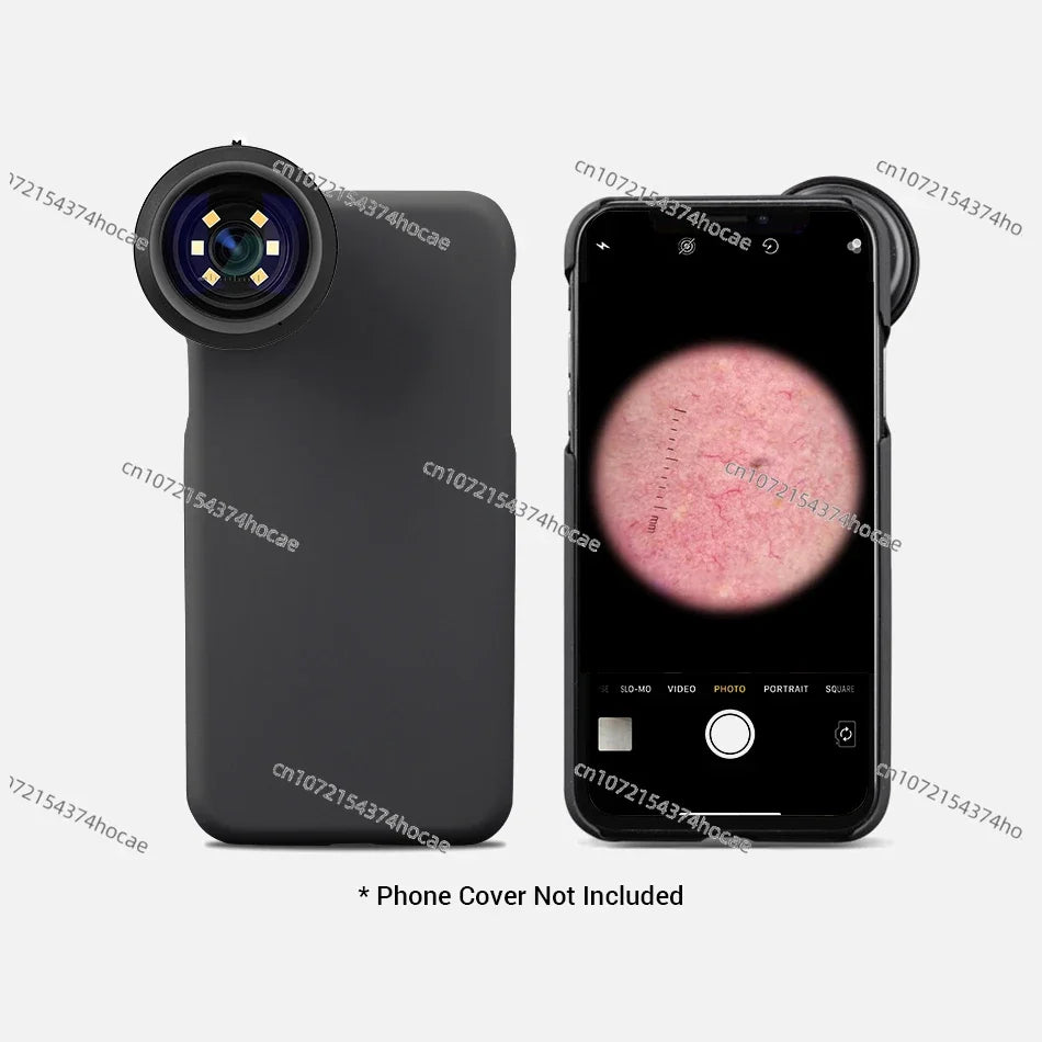 IBOOLO Rechargeable Skin Cancer Analyzer Machine DE-400 Mobile Phone Dermatoscope - My Store
