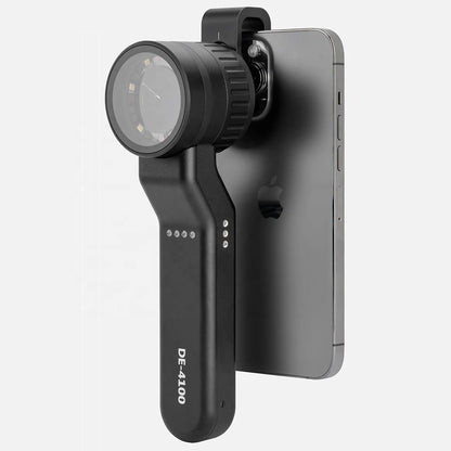 IBOOLO DE-4100 New Diagnostic Dermatoscope Optical 10x zoom dermatoscope, The world's most trusted hand-held dermatoscope - My Store